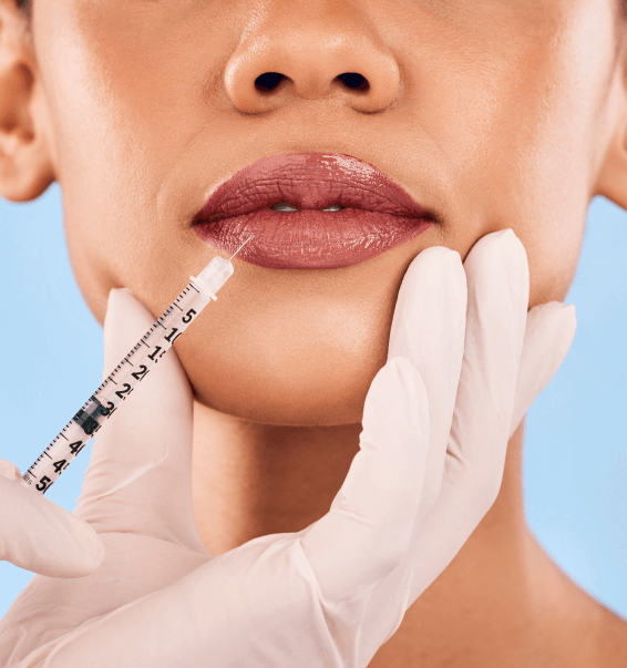 Qway Medspa Fillers Treatment