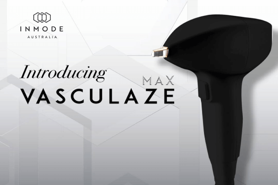Max Vasculaze treatment for visible veins on a patient’s leg.